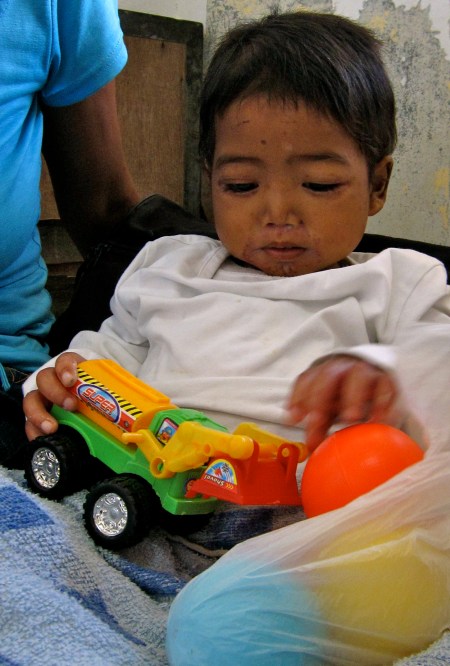 Three-year-old Longlong will soon ready to be discharged back home to the family's small community of Dutu-Davao. A few weeks after the typhoon, he was admitted to hospital with complications related to severe acute malnutrition.
